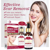 Aichun Beauty Remove Scars Whitening Facial Serum Kojic Acid & Vitamin E - 30ml Aichun Beauty