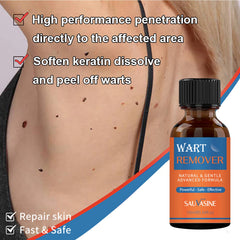 Sauvasine Wart Remover - 10ml Sauvasine