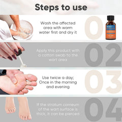 Sauvasine Wart Remover - 10ml Sauvasine