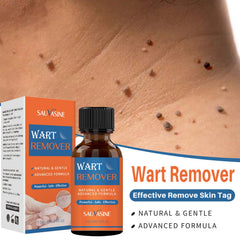 Sauvasine Wart Remover - 10ml Sauvasine