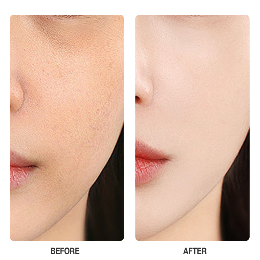 Skinever Vitamin C Brightening Toner - 100ml Skinever