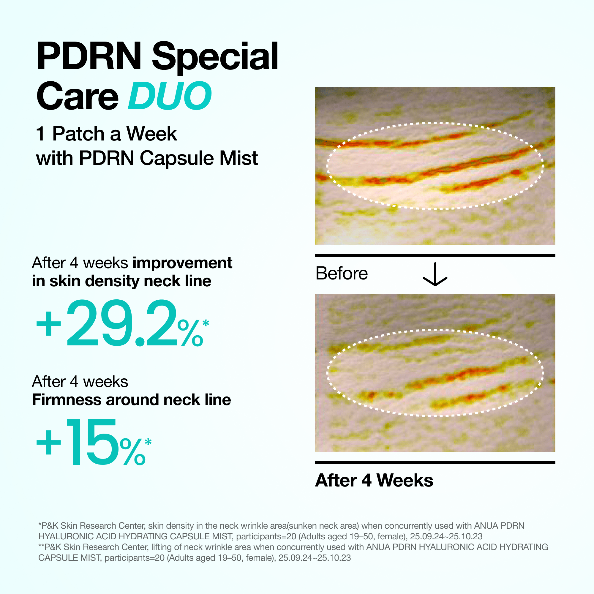 ANUA PDRN Special Collagen Care – Melting Patch for Glass Skin (4 Sheets) Anua