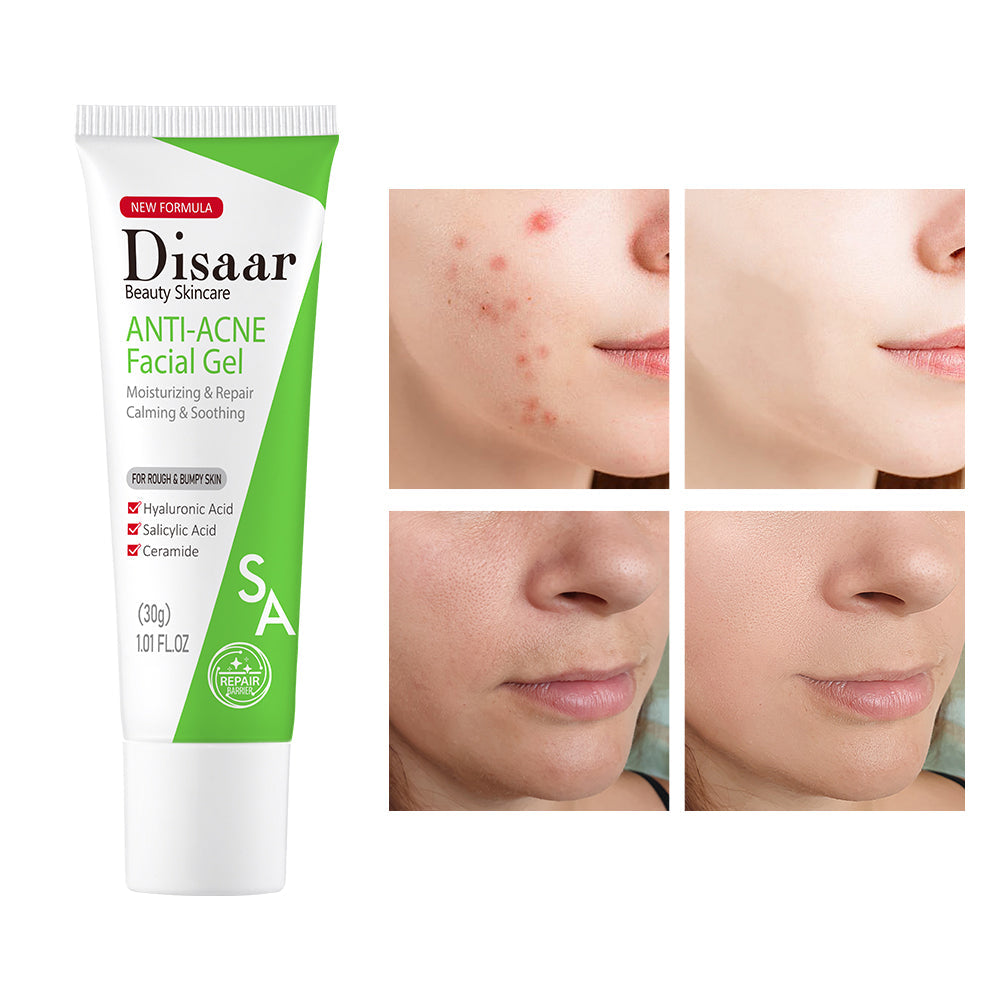 Disaar SA Anti-Acne Facial Gel - 30g Disaar
